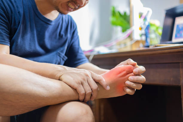 Detoxifying Uric Acid: Understanding Causes and Natural Remedies 2 6606328702c7526195ae28f6 gout