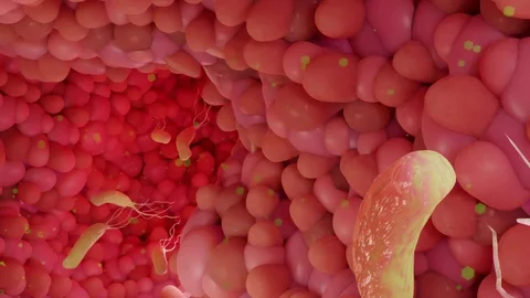 7 Warning Signs You May Have Parasites and How to Treat Them Naturally 2 9