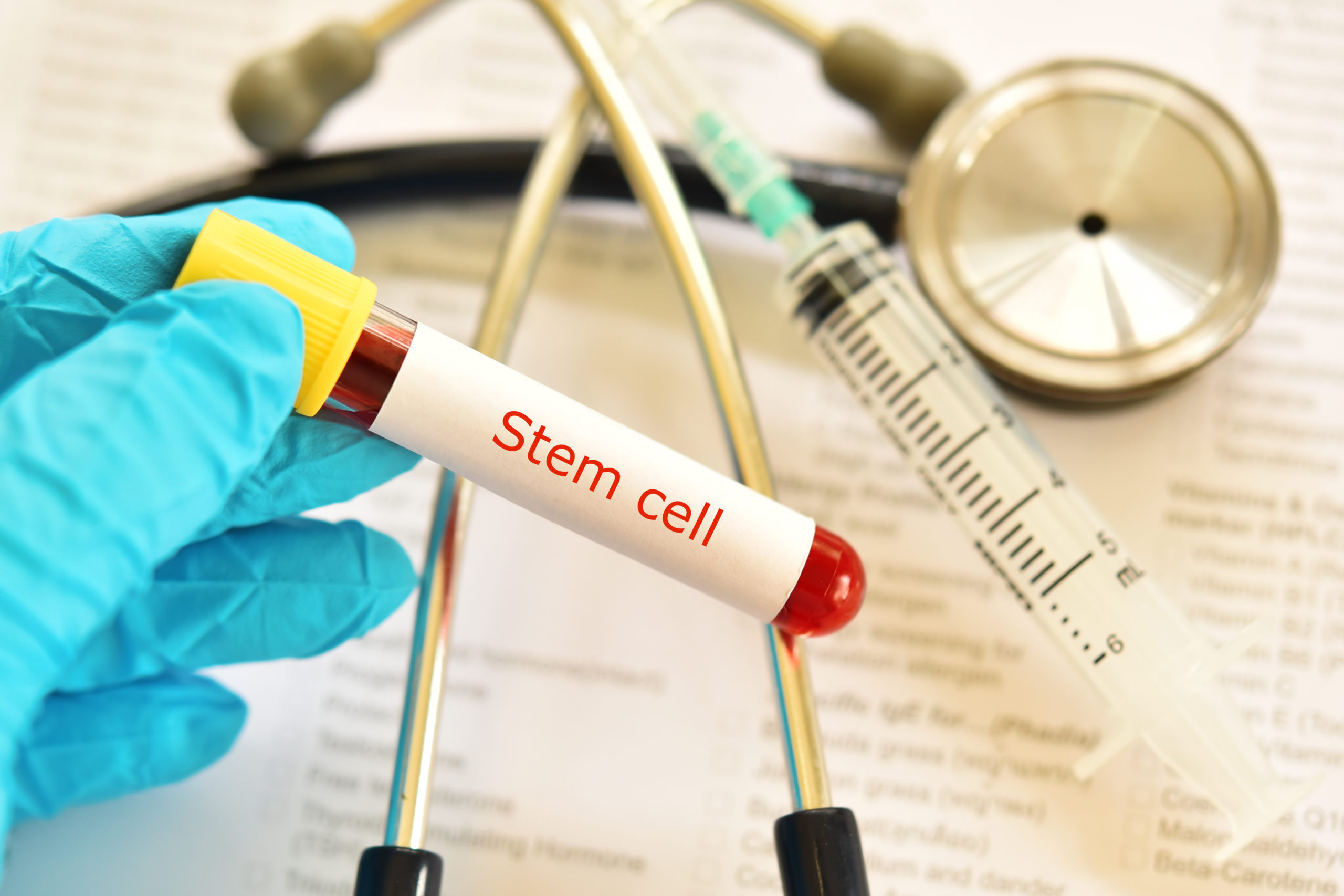 stem cells