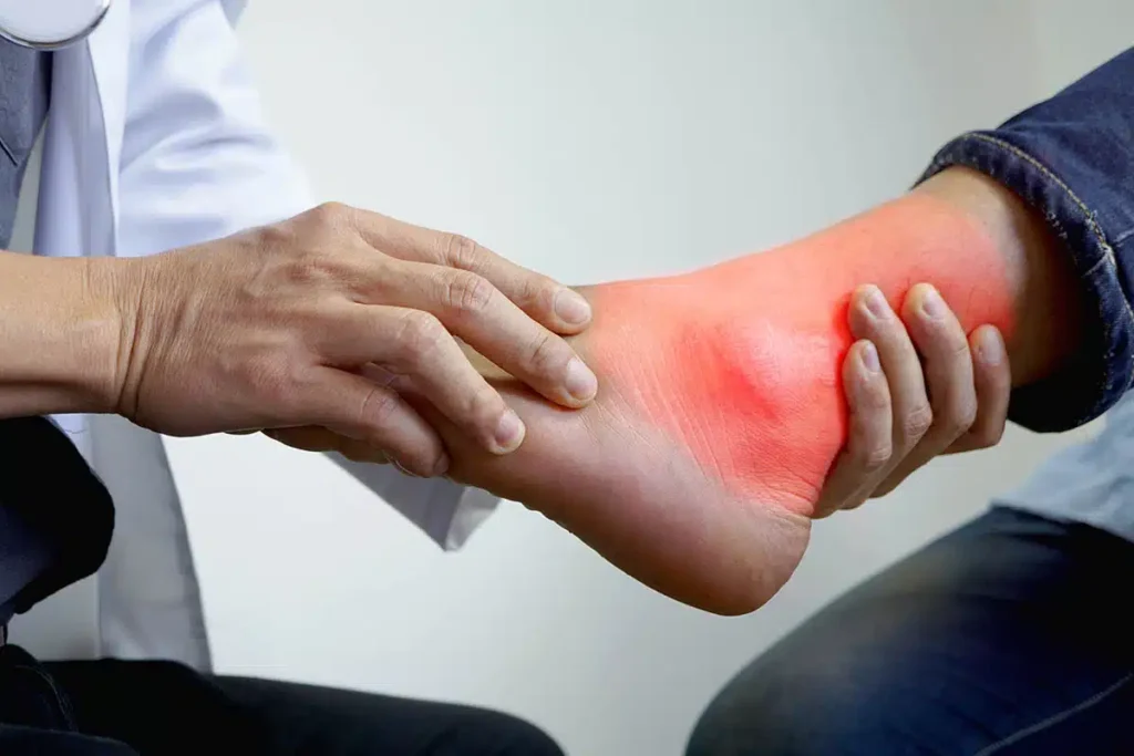 Detoxifying Uric Acid: Understanding Causes and Natural Remedies 3 shutterstock 791189557